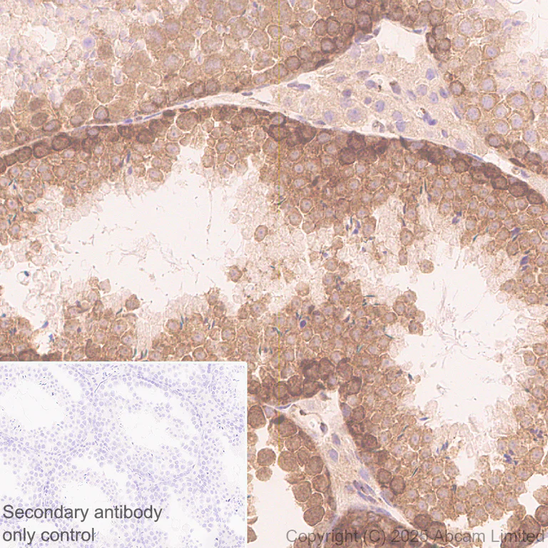 Immunohistochemistry (Formalin/PFA-fixed paraffin-embedded sections) - Anti-IMPDH2 antibody [EPR29835-594] - BSA and Azide free (AB323877)