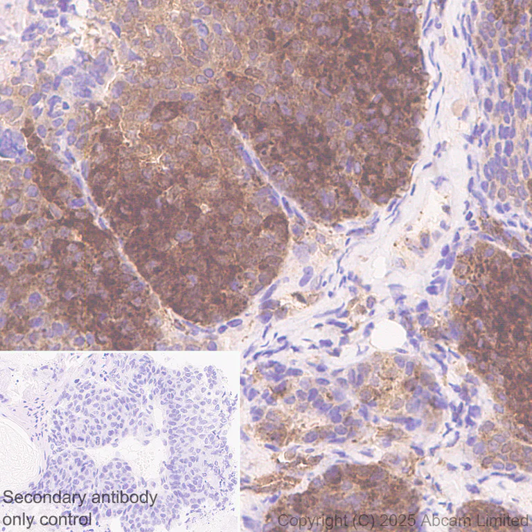 Immunohistochemistry (Formalin/PFA-fixed paraffin-embedded sections) - Anti-IMPDH2 antibody [EPR29835-594] - BSA and Azide free (AB323877)