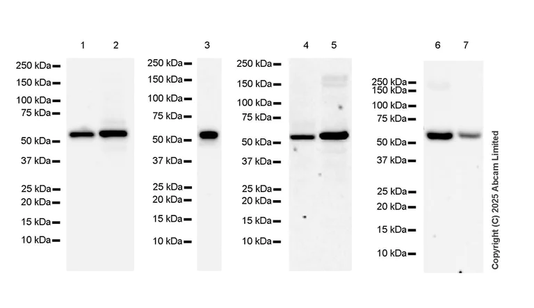 Western blot - Anti-IMPDH2 antibody [EPR29835-594] - BSA and Azide free (AB323877)