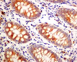 Immunohistochemistry (Formalin/PFA-fixed paraffin-embedded sections) - Anti-IMPDH2 antibody [EPR8364(B)] (AB131158), expandable thumbnail