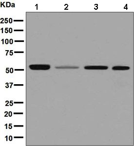Western blot - Anti-IMPDH2 antibody [EPR8364(B)] (AB131158), expandable thumbnail