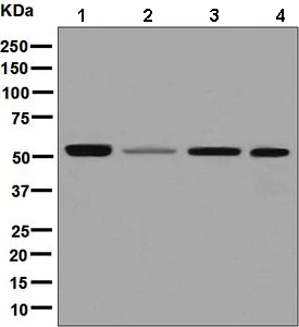 Western blot - Anti-IMPDH2 antibody [EPR8364(B)] (AB131158)