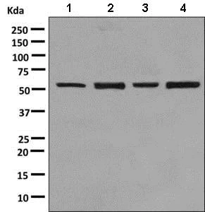 Western blot - Anti-IMPDH2 + IMPDH1 antibody [EPR9678(B)] (AB137120)