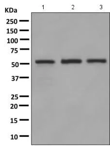 Western blot - Anti-IMPDH2 + IMPDH1 antibody [EPR9679(B)] - BSA and Azide free (AB248826)