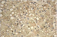 Immunohistochemistry (Formalin/PFA-fixed paraffin-embedded sections) - Anti-IMPG1 antibody (AB113493), expandable thumbnail