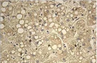 Immunohistochemistry (Formalin/PFA-fixed paraffin-embedded sections) - Anti-IMPG1 antibody (AB113493)