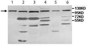 Western blot - Anti-IMPG1 antibody (AB113493), expandable thumbnail