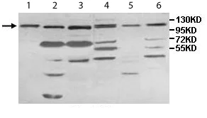 Western blot - Anti-IMPG1 antibody (AB113493)