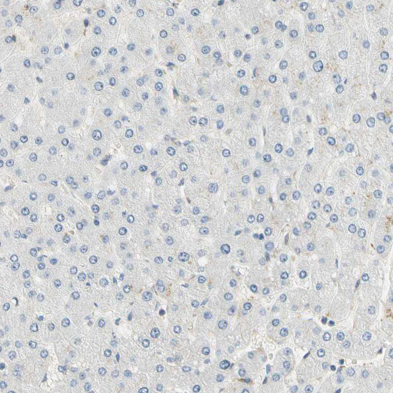 Immunohistochemistry (Formalin/PFA-fixed paraffin-embedded sections) - Anti-IMPG2 antibody (AB272558)