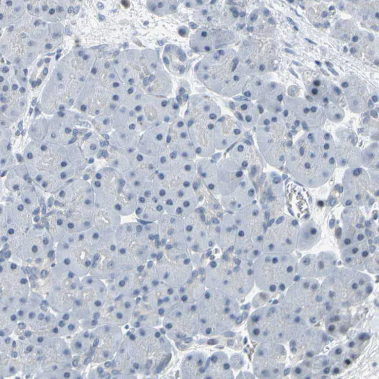 Immunohistochemistry (Formalin/PFA-fixed paraffin-embedded sections) - Anti-IMPG2 antibody (AB272558)