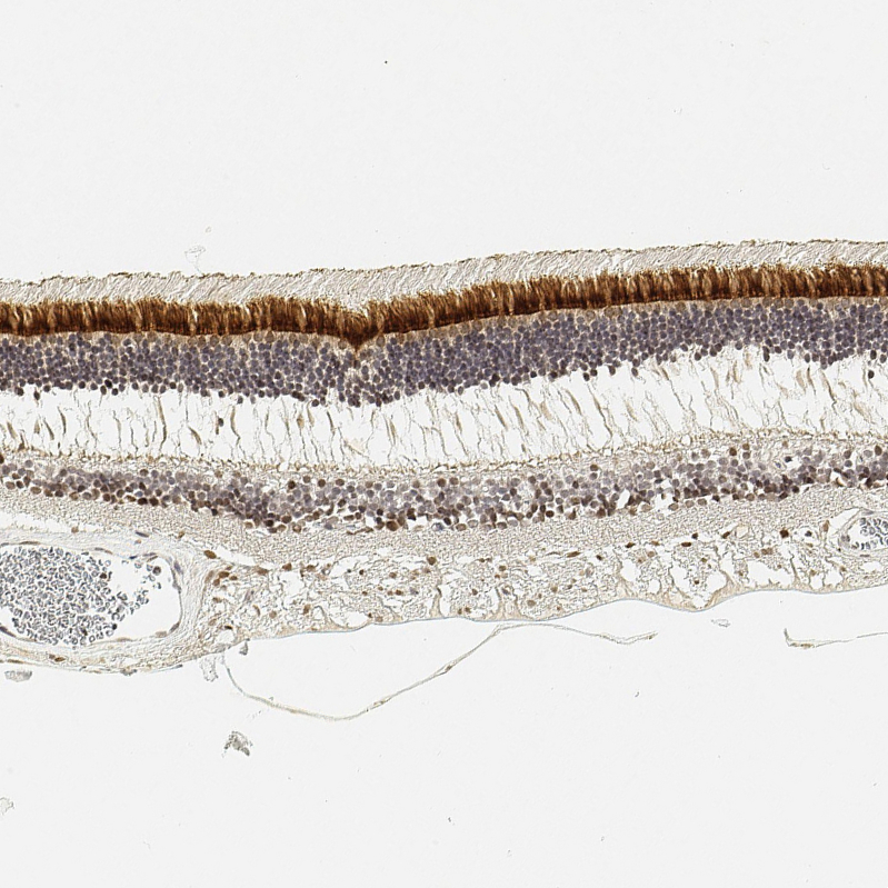 Immunohistochemistry (Formalin/PFA-fixed paraffin-embedded sections) - Anti-IMPG2 antibody (AB272558)