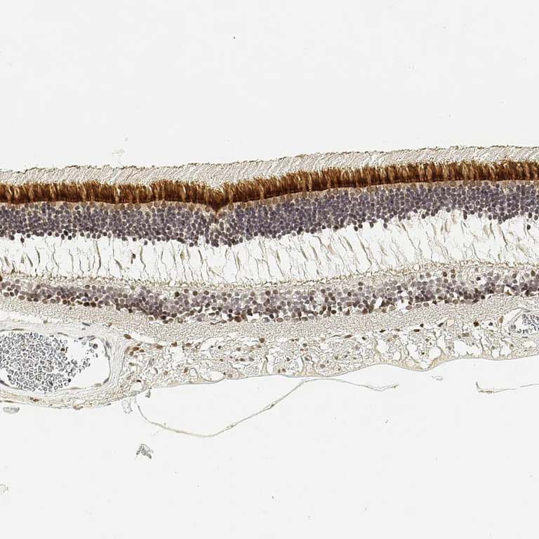 Immunohistochemistry (Formalin/PFA-fixed paraffin-embedded sections) - Anti-IMPG2 antibody (AB272558)