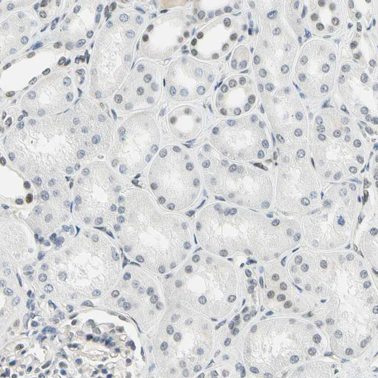 Immunohistochemistry (Formalin/PFA-fixed paraffin-embedded sections) - Anti-IMPG2 antibody (AB272558)