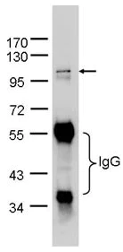 Immunoprecipitation - Anti-Importin 13 antibody (AB95993)