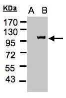 Western blot - Anti-Importin 13 antibody (AB95993)
