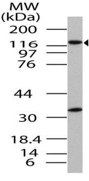 Western blot - Anti-Importin 8 antibody (AB208162)