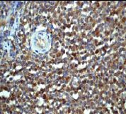 Immunohistochemistry (Formalin/PFA-fixed paraffin-embedded sections) - Anti-Importin 9/RANBP9 antibody [EP1353Y] (AB52605)