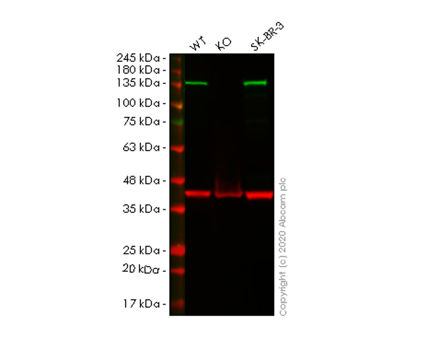 Anti-Importin 9/RANBP9 antibody [EP1353Y]