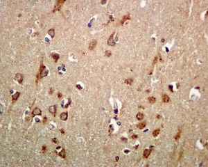 Immunohistochemistry (Formalin/PFA-fixed paraffin-embedded sections) - Anti-Importin 9/RANBP9 antibody [EPR1352] (AB124710), expandable thumbnail
