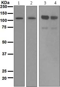 Western blot - Anti-Importin 9/RANBP9 antibody [EPR1352] (AB124710), expandable thumbnail