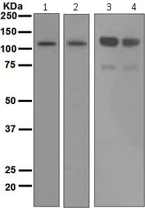 Western blot - Anti-Importin 9/RANBP9 antibody [EPR1352] (AB124710)
