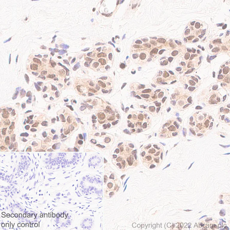 Immunohistochemistry (Formalin/PFA-fixed paraffin-embedded sections) - Anti-Importin subunit alpha antibody [EPR26346-53] (AB307438)
