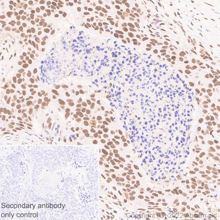 Immunohistochemistry (Formalin/PFA-fixed paraffin-embedded sections) - Anti-Importin subunit alpha antibody [EPR26346-53] (AB307438)