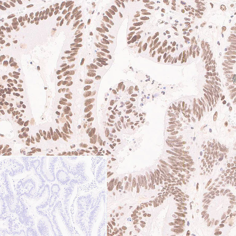 Immunohistochemistry (Formalin/PFA-fixed paraffin-embedded sections) - Anti-Importin subunit alpha antibody [EPR26346-53] (AB307438)
