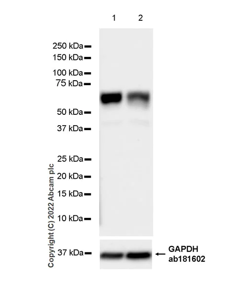 Western blot - Anti-Importin subunit alpha antibody [EPR26346-53] (AB307438)