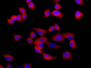 Immunocytochemistry/ Immunofluorescence - Anti-Importin4/Imp4 antibody [EPR13660] (AB181046), expandable thumbnail