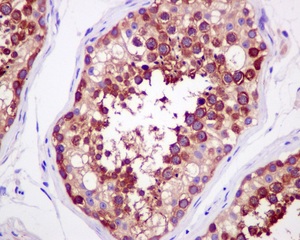 Immunohistochemistry (Formalin/PFA-fixed paraffin-embedded sections) - Anti-Importin4/Imp4 antibody [EPR13660] (AB181046), expandable thumbnail