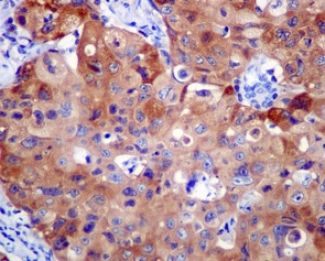 Immunohistochemistry (Formalin/PFA-fixed paraffin-embedded sections) - Anti-Importin4/Imp4 antibody [EPR13660] (AB181046), expandable thumbnail