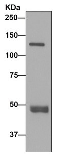Immunoprecipitation - Anti-Importin4/Imp4 antibody [EPR13660] (AB181046), expandable thumbnail