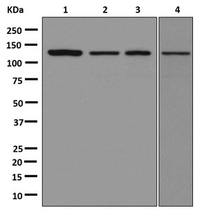 Western blot - Anti-Importin4/Imp4 antibody [EPR13660] (ab181046), expandable thumbnail