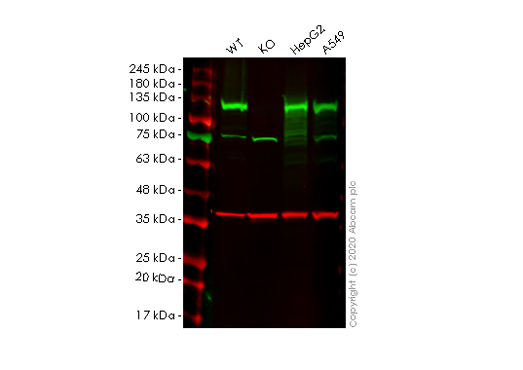 Western blot - Anti-Importin4/Imp4 antibody [EPR13660] (AB181046), expandable thumbnail