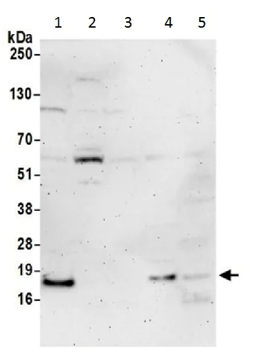 Western blot - Anti-IMUP antibody (AB228823)