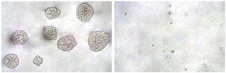 Functional Studies - In Vitro Tumor Sensitivity Assay (Soft Agar Colony Formation) (AB325583)