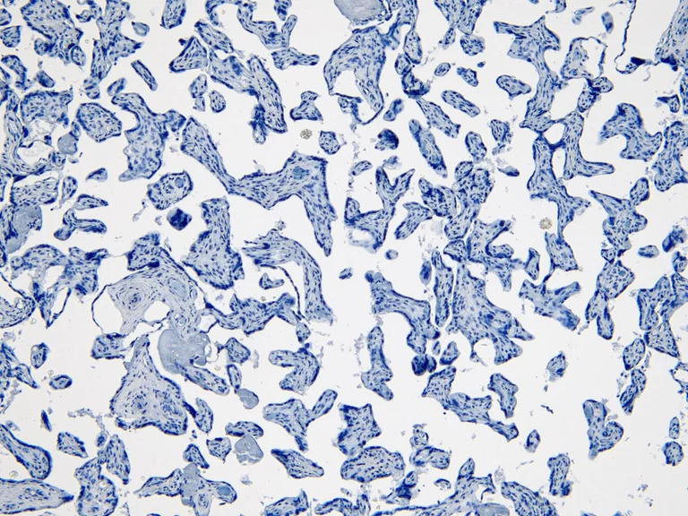 Immunohistochemistry (Formalin/PFA-fixed paraffin-embedded sections) - Anti-Indoleamine 2, 3-dioxygenase antibody (AB134197)