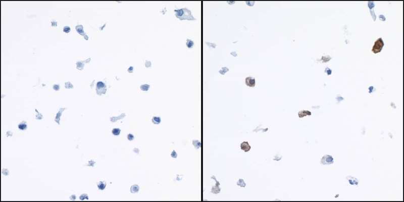 Immunocytochemistry - Anti-Indoleamine 2, 3-dioxygenase antibody [BLR031F] (AB243888), expandable thumbnail