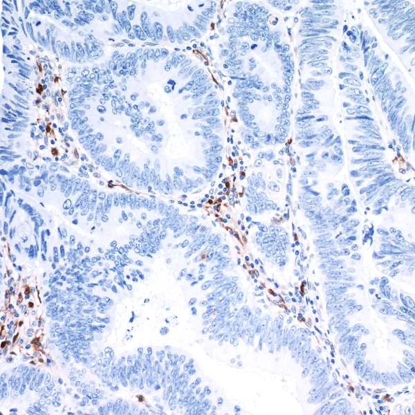 Immunohistochemistry (Formalin/PFA-fixed paraffin-embedded sections) - Anti-Indoleamine 2, 3-dioxygenase antibody [BLR031F] (AB243888)