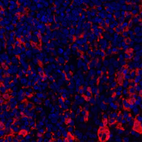 Immunohistochemistry (Formalin/PFA-fixed paraffin-embedded sections) - Anti-Indoleamine 2, 3-dioxygenase antibody [BLR031F] (ab243888), expandable thumbnail