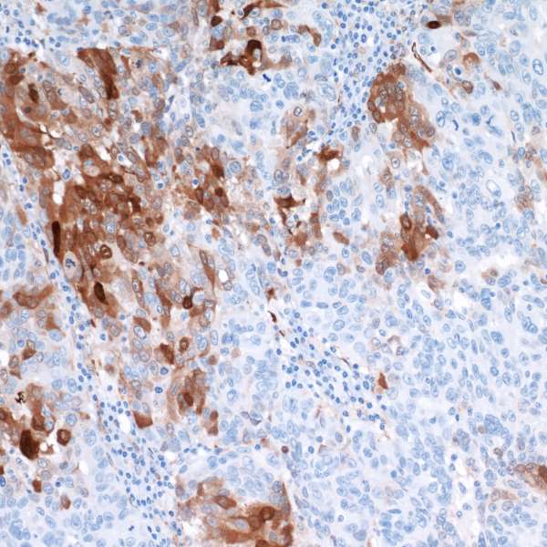 Immunohistochemistry (Formalin/PFA-fixed paraffin-embedded sections) - Anti-Indoleamine 2, 3-dioxygenase antibody [BLR031F] (AB243888), expandable thumbnail