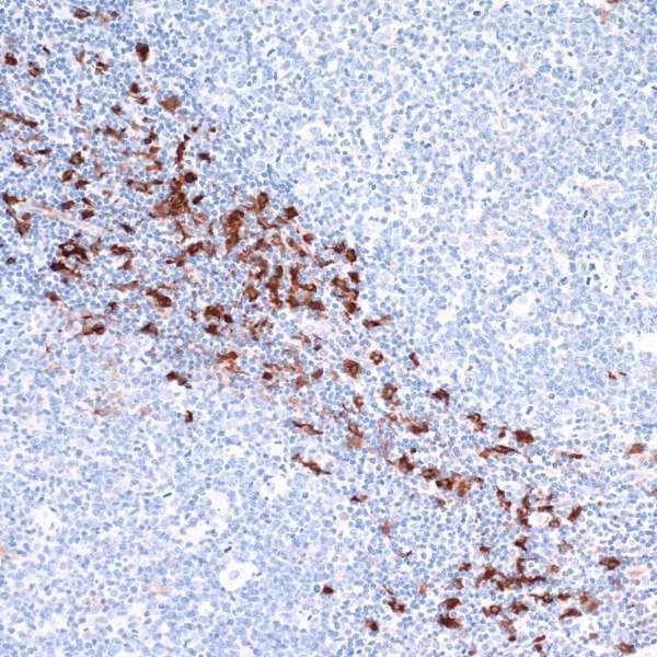 Immunohistochemistry (Formalin/PFA-fixed paraffin-embedded sections) - Anti-Indoleamine 2, 3-dioxygenase antibody [BLR031F] (AB243888), expandable thumbnail