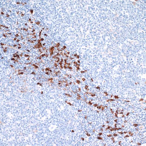 Immunohistochemistry (Formalin/PFA-fixed paraffin-embedded sections) - Anti-Indoleamine 2, 3-dioxygenase antibody [BLR031F] (AB243888)