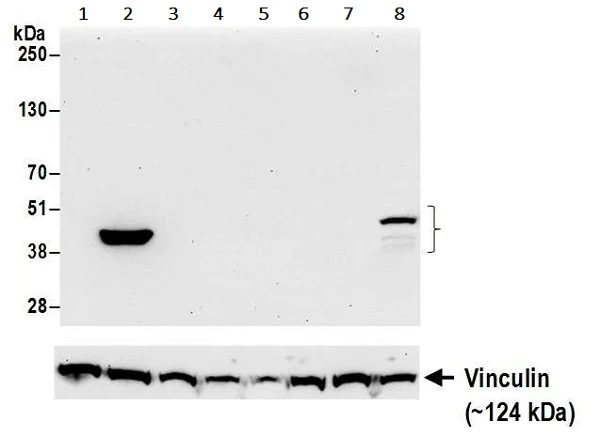 Western blot - Anti-Indoleamine 2, 3-dioxygenase antibody [BLR031F] (AB243888)