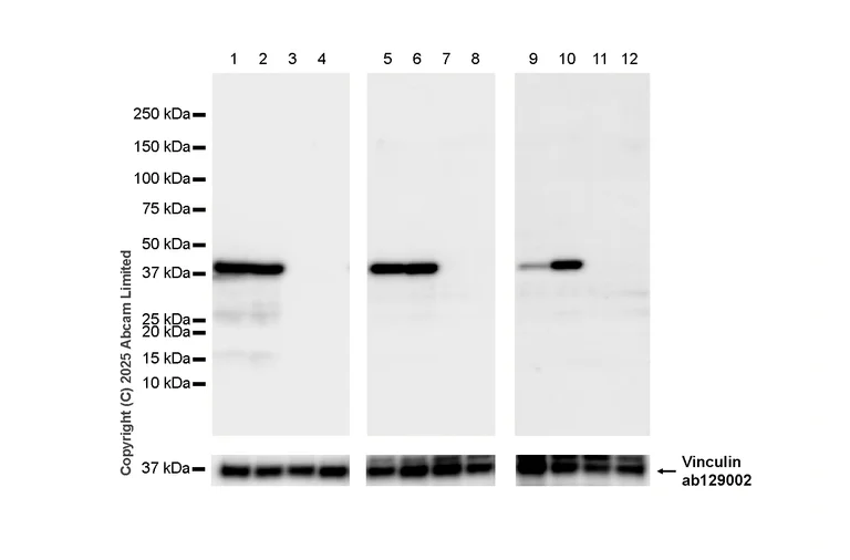 Western blot - Anti-Indoleamine 2, 3-dioxygenase antibody [EPR24032-22] - BSA and Azide free (AB277531)