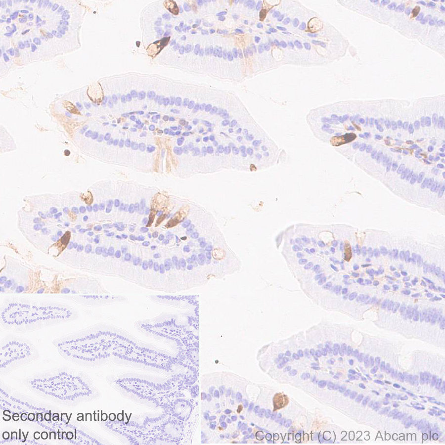 Immunohistochemistry (Formalin/PFA-fixed paraffin-embedded sections) - Anti-Indoleamine 2, 3-dioxygenase antibody [EPR28349-89] (ab311847), expandable thumbnail
