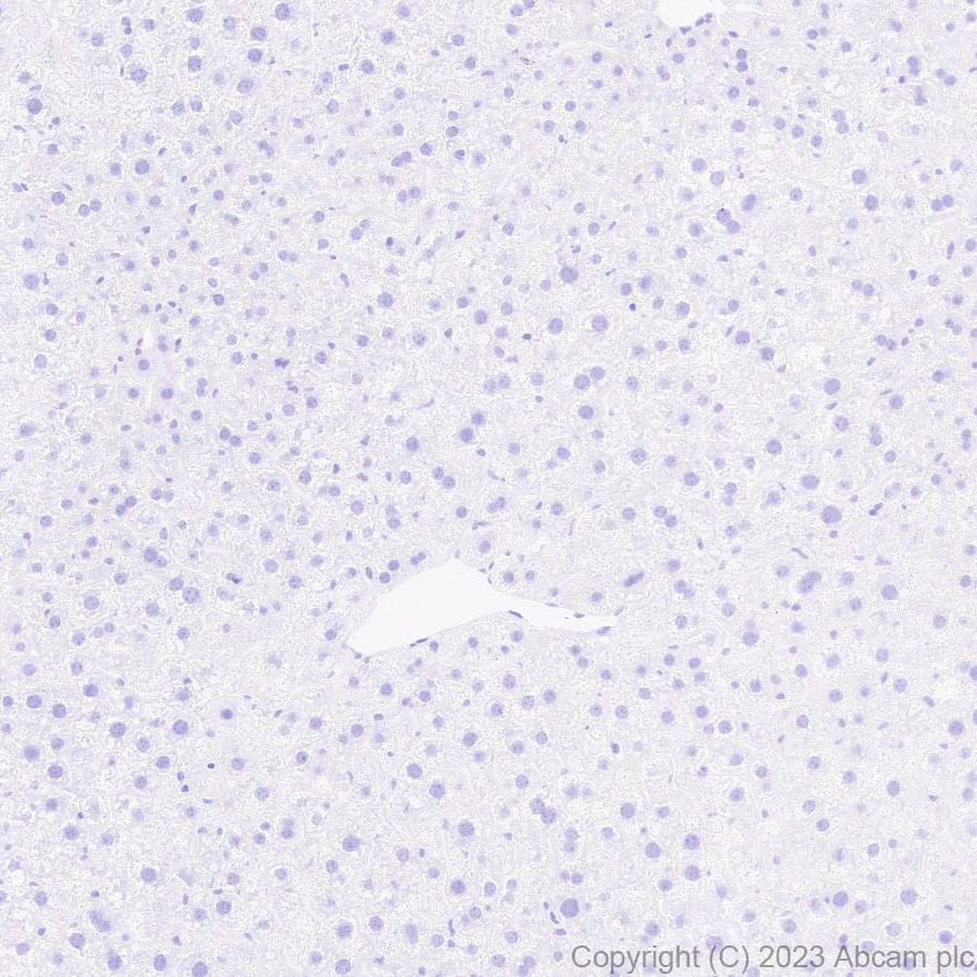 Immunohistochemistry (Formalin/PFA-fixed paraffin-embedded sections) - Anti-Indoleamine 2, 3-dioxygenase antibody [EPR28349-89] (ab311847), expandable thumbnail