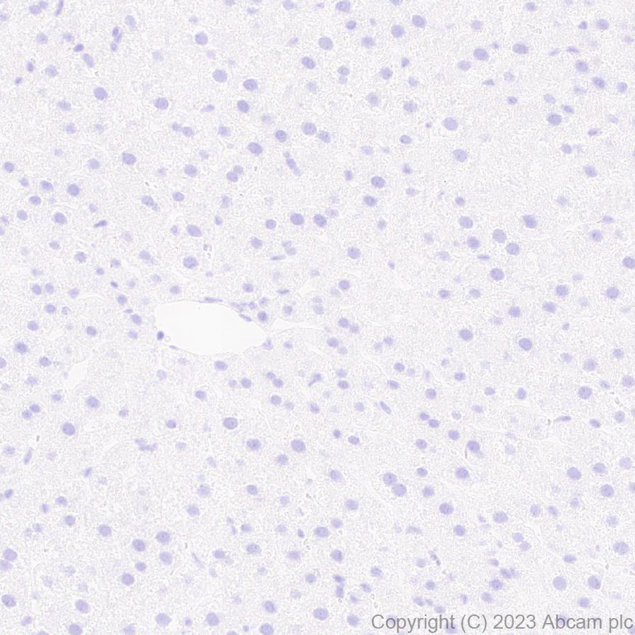 Immunohistochemistry (Formalin/PFA-fixed paraffin-embedded sections) - Anti-Indoleamine 2, 3-dioxygenase antibody [EPR28349-89] (AB311847), expandable thumbnail