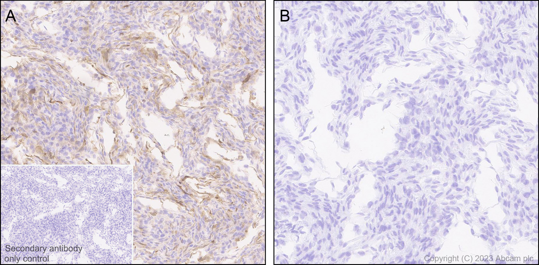 Immunohistochemistry (Formalin/PFA-fixed paraffin-embedded sections) - Anti-Indoleamine 2, 3-dioxygenase antibody [EPR28349-89] (ab311847), expandable thumbnail